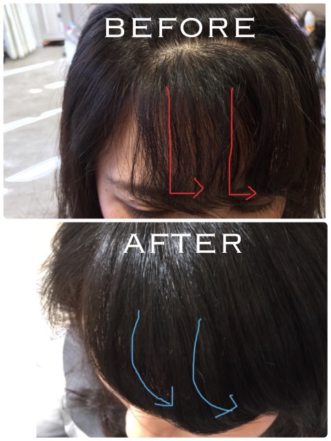 施術例 Before After クセ毛で髪を艶髪にする方法 縮毛矯正 クセ毛専門美容院