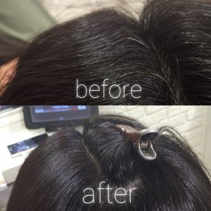 【施術例】Before&After　縮毛矯正の失敗で根元が折れてしまった髪の修正例