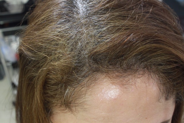 施術例 Before After 顔周りの強いクセ毛の修正例 縮毛矯正 クセ毛専門美容院